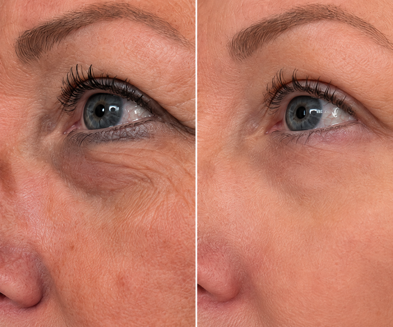 Before and after — Catherine S.